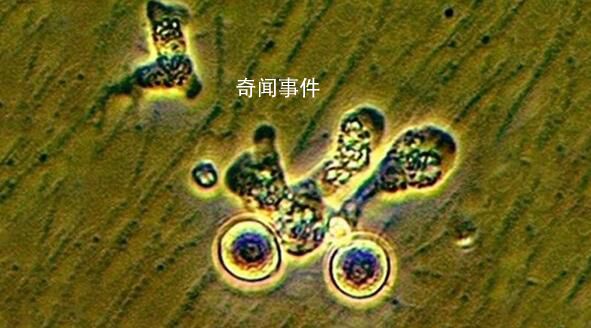 韓國(guó)報(bào)告首例“食腦蟲(chóng)”病例 從泰國(guó)回國(guó)后死亡