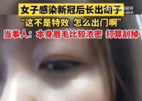 女生回應感染新冠后長出胡子 稱這不是特效