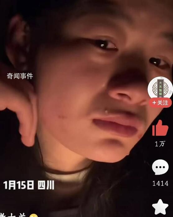 女孩稱因戴了弟弟帽子被母親打 臉上下巴出現(xiàn)很多指甲印和血漬