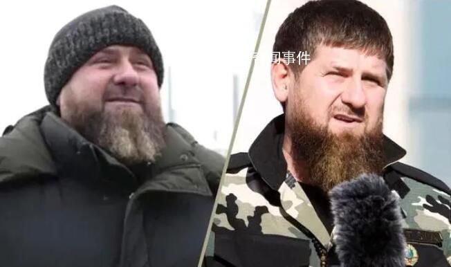 車臣領導人卡德羅夫被傳病重 引發西方媒體對他健康狀況的猜測