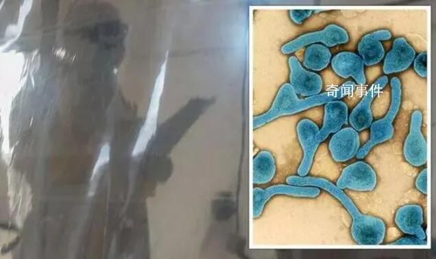非洲致命疾病:出現(xiàn)癥狀24小時(shí)內(nèi)死亡