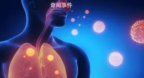 多國出現(xiàn)偏肺病毒感染 尚無治療藥物