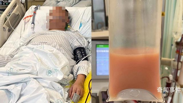 男子熬夜喝冰鎮(zhèn)飲料被送進(jìn)ICU 突然出現(xiàn)了劇烈的腹痛