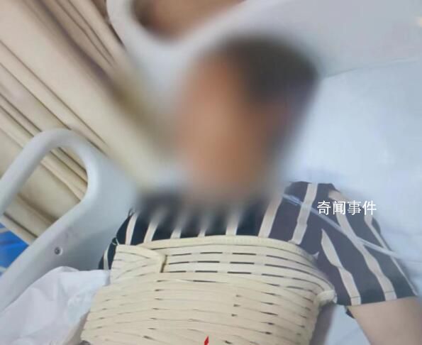 奶奶疑罵孫子被誤會(huì)遭圍毆骨折 造成3根肋骨骨折
