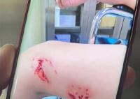 北海一浴場突發(fā)不明魚類傷人事件 事發(fā)時水體十分渾濁漂浮有垃圾