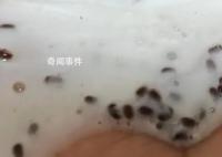女生稱(chēng)海飛絲洗發(fā)水?dāng)D出大量蟲(chóng)卵 實(shí)在是太惡心了