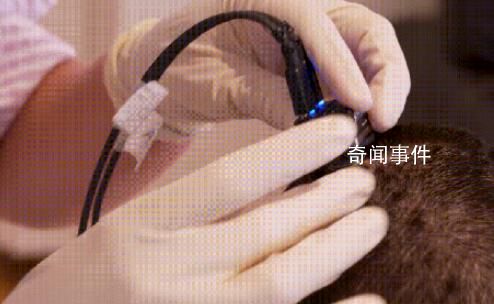 腦機(jī)接口,幫人開口