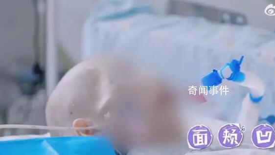那些因厭食癥差點(diǎn)死掉的女孩 厭食癥到底是種怎樣的疾病