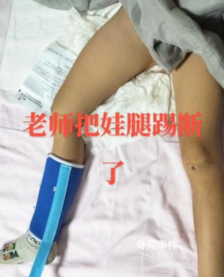 陜西一學生被老師踢斷腿骨?官方回應