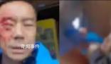 游客遭穿制服人員毆打 其妻發(fā)聲