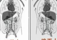 女子就醫(yī)發(fā)現(xiàn)五臟六腑全長反 什么是鏡面人