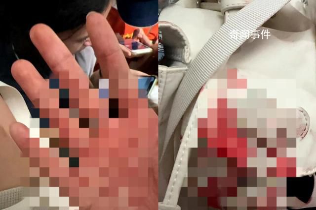 中國游客遇襲身亡:源計劃凌晨回國