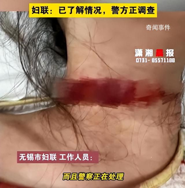 女子稱孕期遭家暴被丈夫拿刀割脖子 目前警方正在調(diào)查處理
