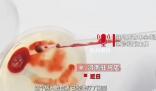 男子誤喝防凍液血液呈膠凍狀離世 治療無(wú)效不幸去世