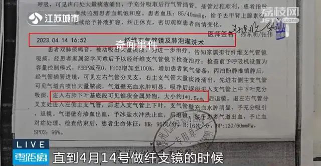 老人術(shù)后體內(nèi)發(fā)現(xiàn)5顆牙和牙套 太離譜了
