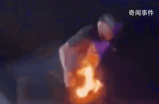 歌手演出被噴火裝置射中褲襠 已對傷口進行處理