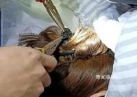 女子出車禍鯊魚夾插入后腦勺