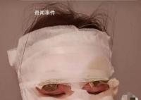 新娘結(jié)婚當(dāng)天被噴霧彩帶燙傷